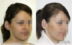 How to increase the term of the clinic How to increase the term of the clinic